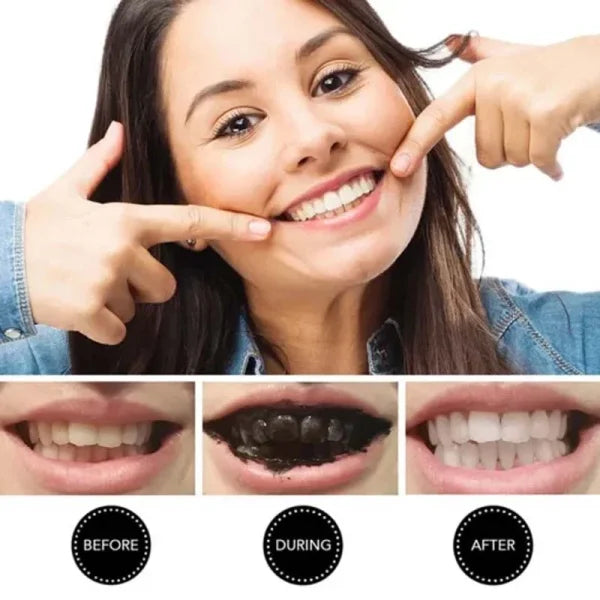 Organic Teeth Whitening Charcoal Powder – Natural 30g Stain Remover