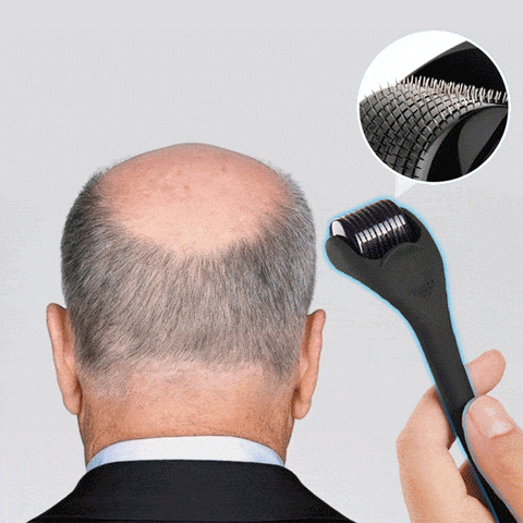 Original Derma Roller System For Hair & Face Treatment With 10 Sizes